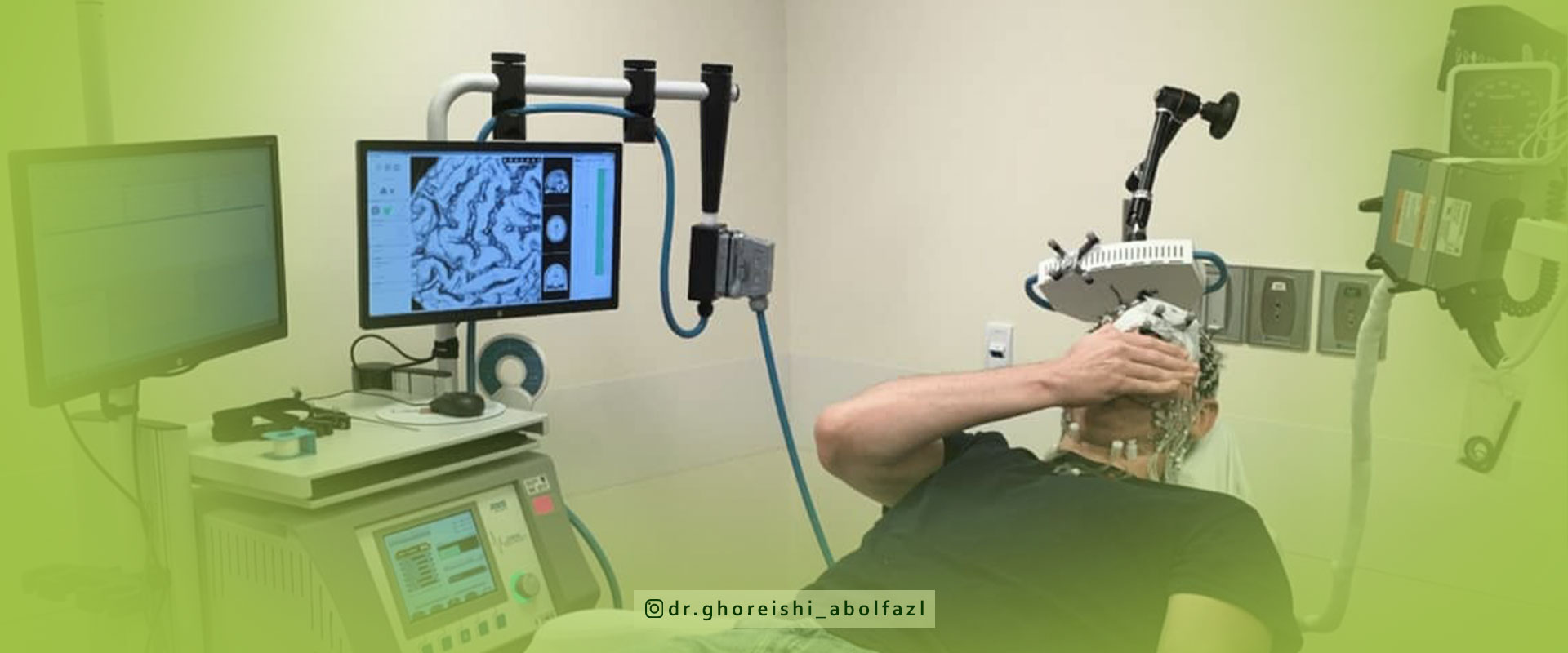 کاربردهای دستگاه rtms