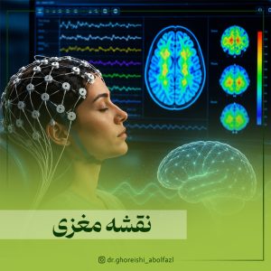 نقشه مغزی یا دستگاه QEEG چیست؟