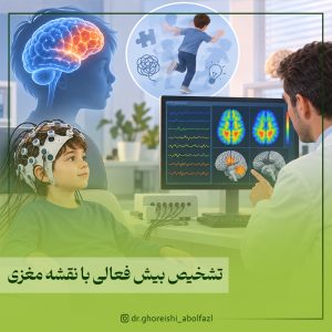 تشخیص بیش فعالی با نقشه مغزی